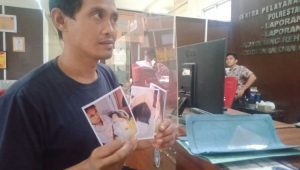 Kasus jari kelingking bayi terpotong