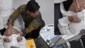 Oknum dokter kandungan di Garut, Jawa Barat diduga lakukan pelecehan terhadap pasien saat lakukan USG | X @kegblgnunfaedh